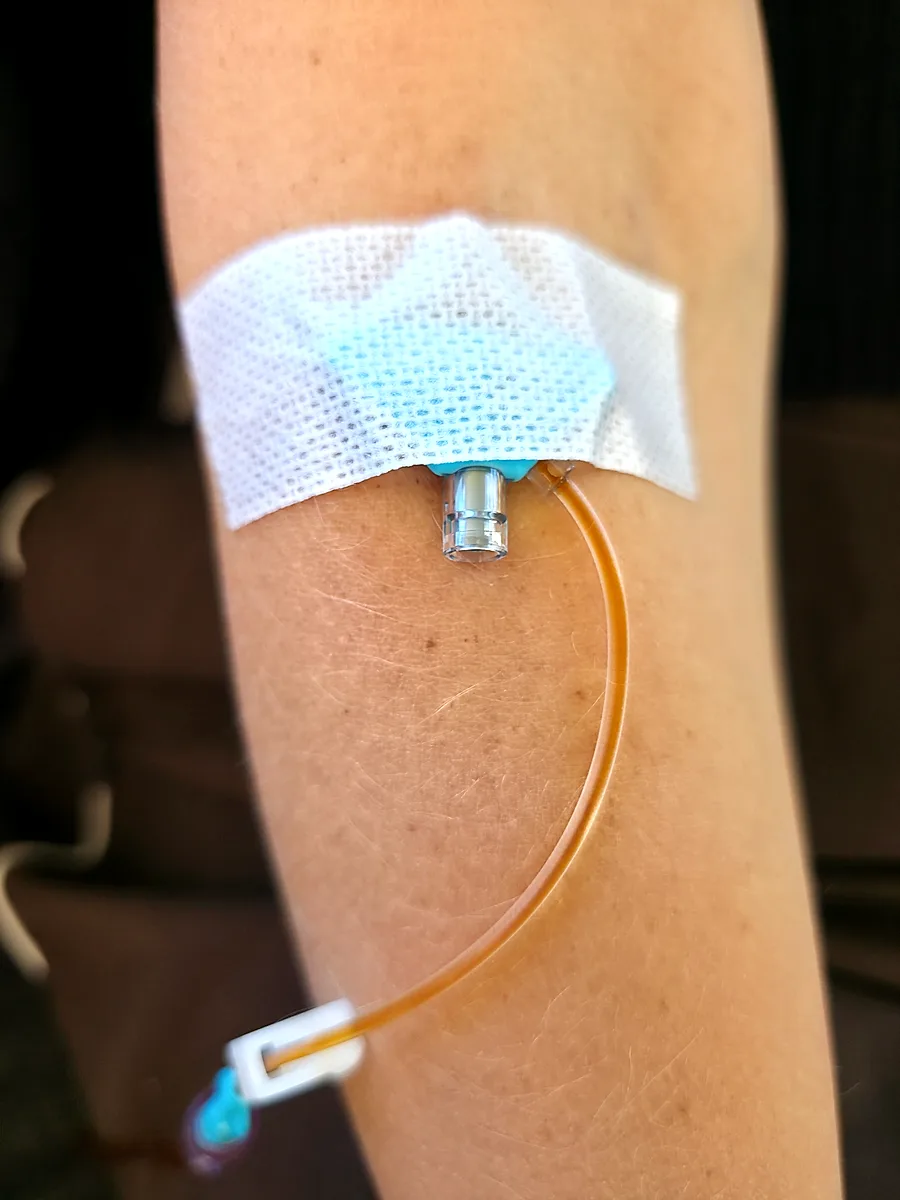 A secured IV line with a sterile dressing on a client's arm during an infusion
